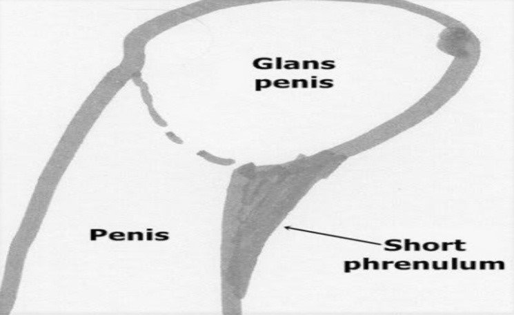 What Happens If Your Frenulum Gets Torn QQRPPZ